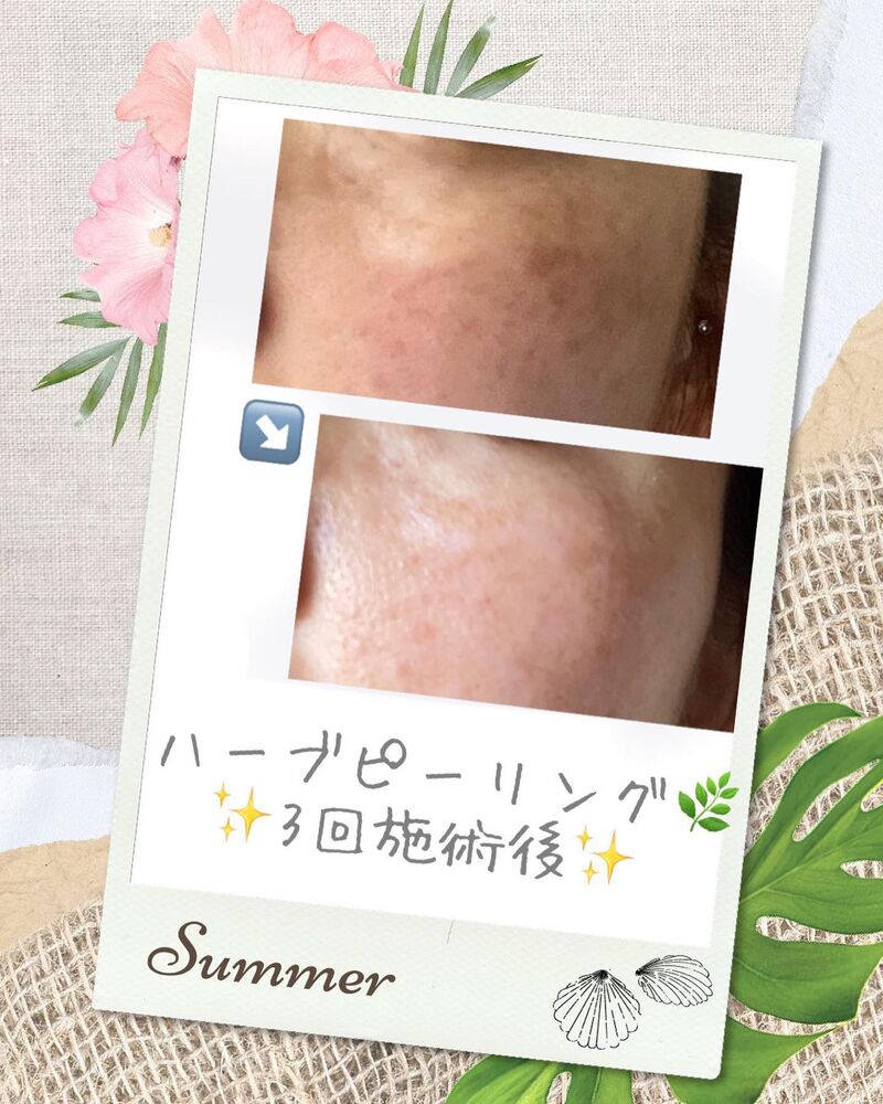 ブログ