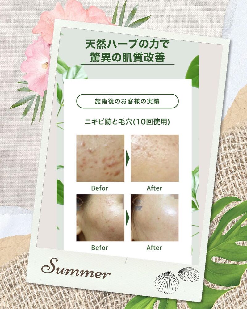ブログ