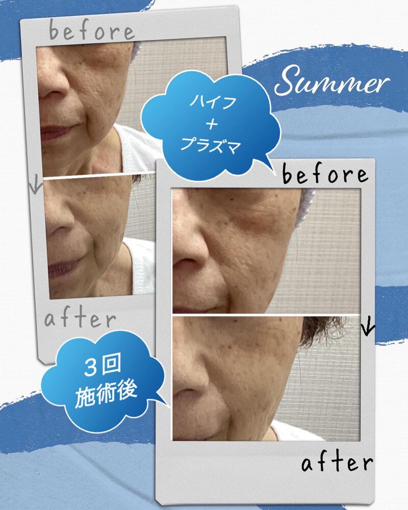 ブログ