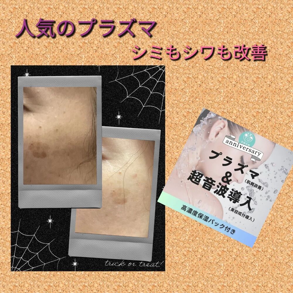ブログ