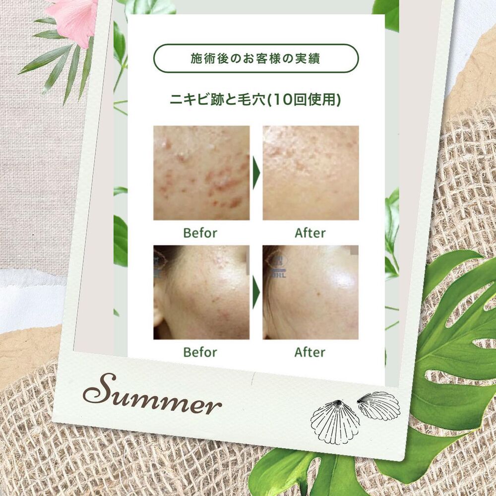 ブログ