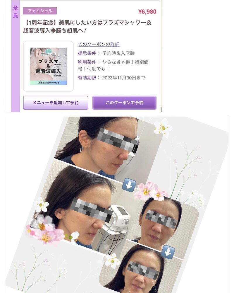 ブログ